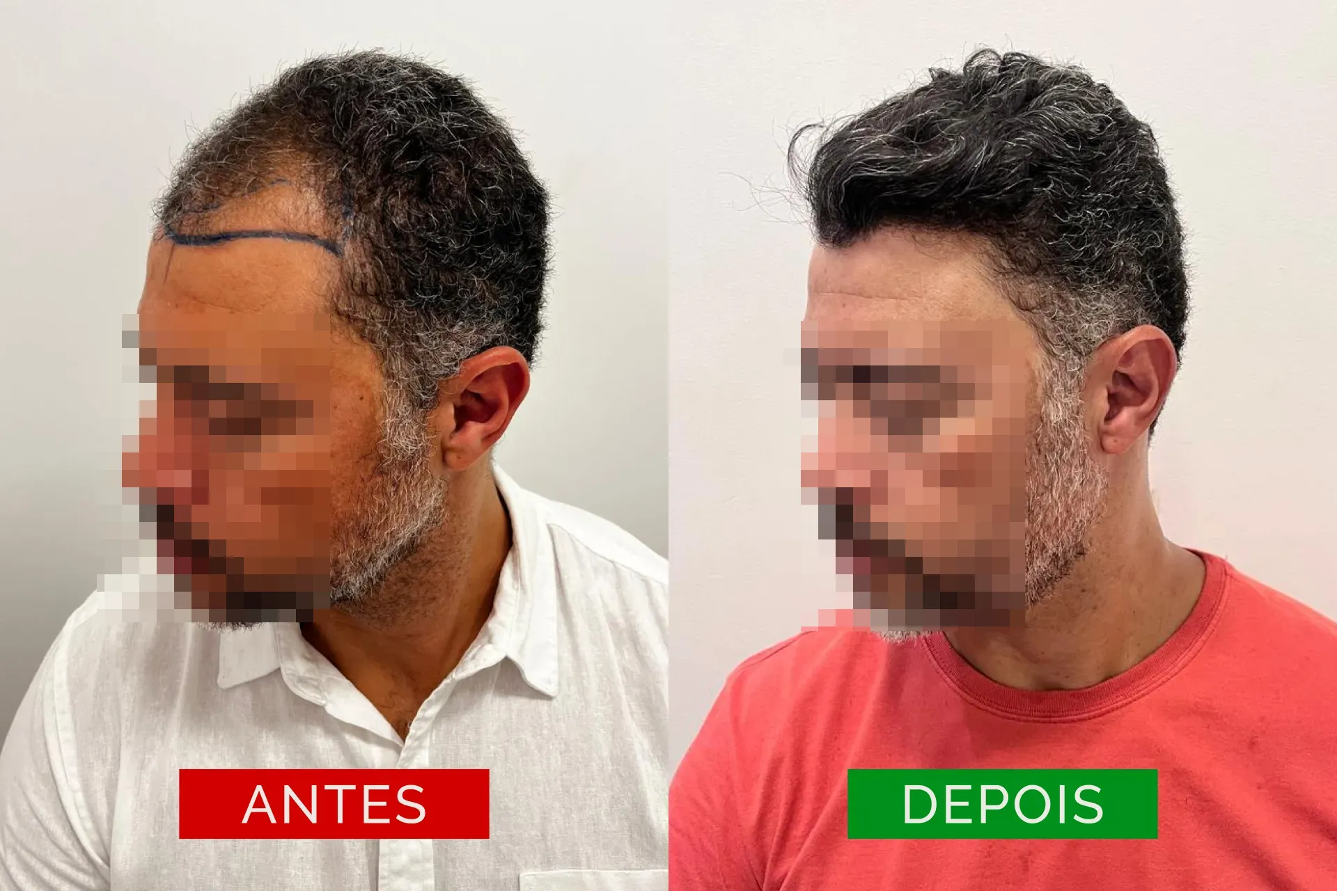 ant_dep_03