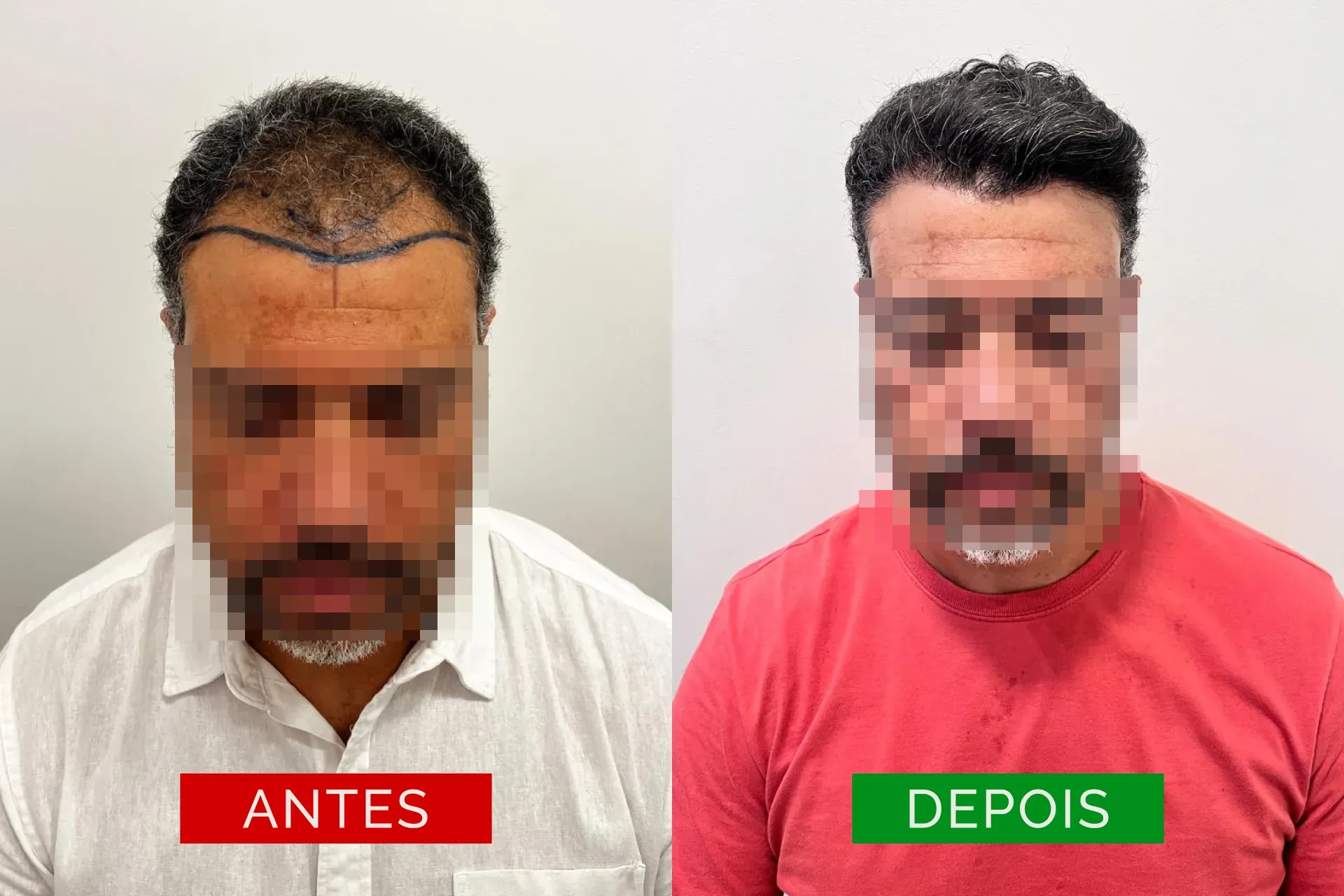 ant_dep_04