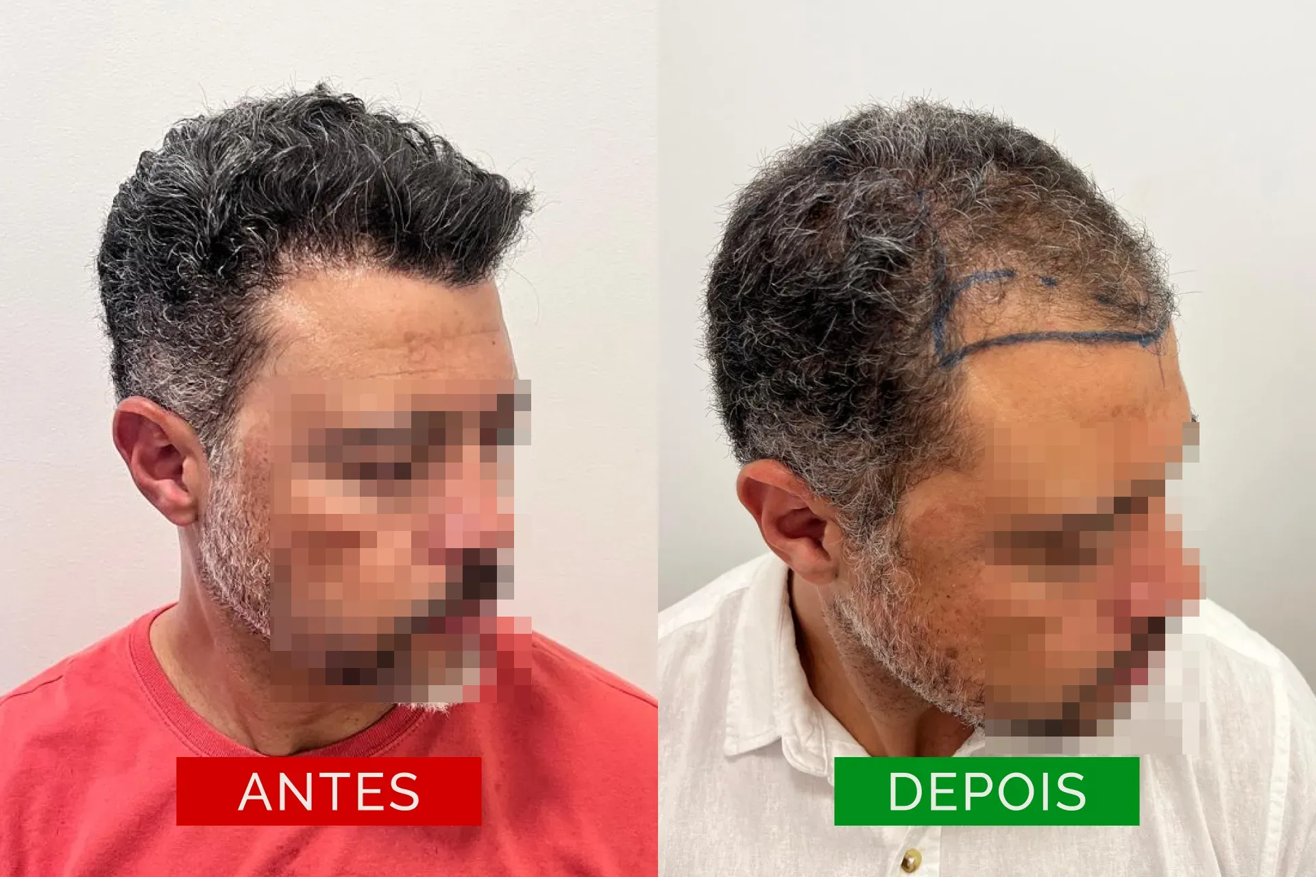ant_dep_05