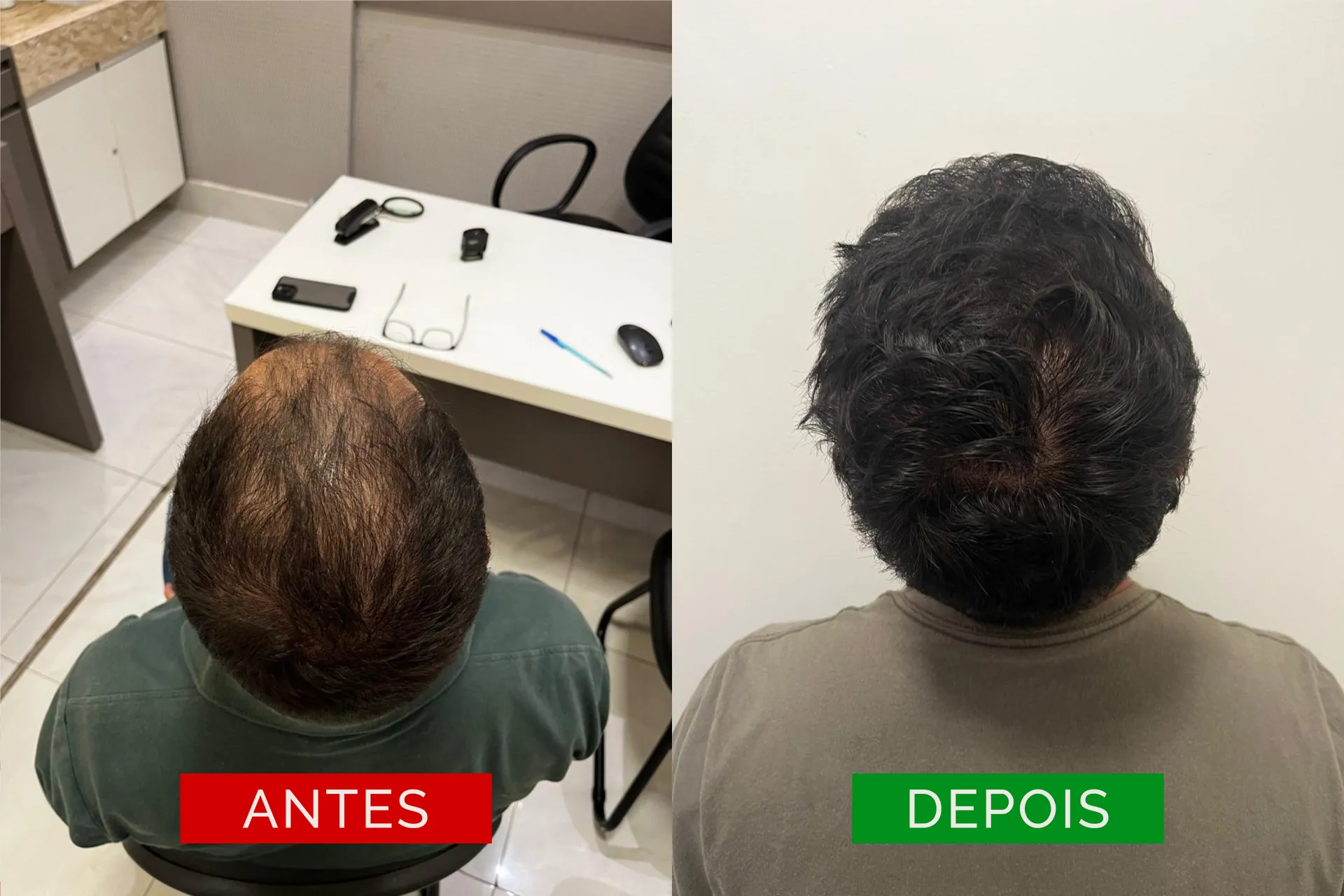 ant_dep_06